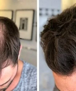 Beste deal π IMPERIO Premium Haarvezels Donkerbruin - Kaalheid Mannen - Alopecia Vrouwen - 100% Onzichtbaar π 39 Beste deal π IMPERIO Premium Haarvezels Donkerbruin - Kaalheid Mannen - Alopecia Vrouwen - 100% Onzichtbaar π -L'OrΓ©al Shop 550x297