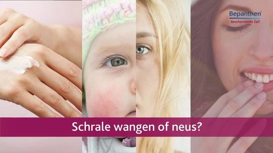 Kopen π Bepanthen Beschermende Zalf - Intensief Vettende Zalf - Zonder Parfum - Droge Of Schrale Huidplekken - 50 Gram β 4 Kopen π Bepanthen Beschermende Zalf - Intensief Vettende Zalf - Zonder Parfum - Droge Of Schrale Huidplekken - 50 Gram β - Afbeelding 2