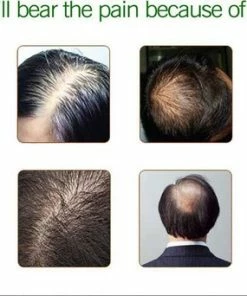 Coupon ⭐ 7Days Ginger Hair Nutrient Solution Haarserum 7days | Haarkuur 7daags | Haaruitval Bestrijden | Gember Extracten Voor Stimuleren Haargroei | Haar Olie | Bewezen Formule 😉 -L'Oréal Shop 550x342 1