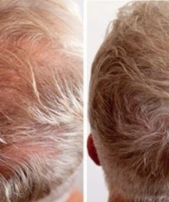 Beste deal π IMPERIO Premium Haarvezels Donkerbruin - Kaalheid Mannen - Alopecia Vrouwen - 100% Onzichtbaar π 41 Beste deal π IMPERIO Premium Haarvezels Donkerbruin - Kaalheid Mannen - Alopecia Vrouwen - 100% Onzichtbaar π -L'OrΓ©al Shop 550x363