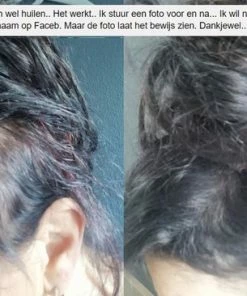 Beste deal π IMPERIO Premium Haarvezels Donkerbruin - Kaalheid Mannen - Alopecia Vrouwen - 100% Onzichtbaar π 33 Beste deal π IMPERIO Premium Haarvezels Donkerbruin - Kaalheid Mannen - Alopecia Vrouwen - 100% Onzichtbaar π -L'OrΓ©al Shop 550x366 3