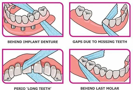 Flash-uitverkoop 👍 IDontix X-Ribbon - 12mtr 🧨 4 Flash-uitverkoop 👍 IDontix X-Ribbon - 12mtr 🧨 - Afbeelding 2