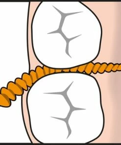 Uitgang ⌛ TePe EasyPick XS-S Oranje 36 Stuks 🎉 -L'Oréal Shop 550x412 13
