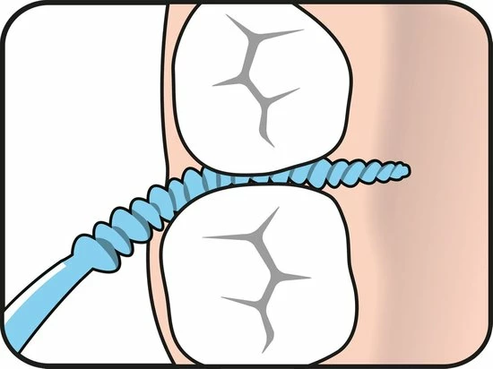 Gloednieuw β TEPE EASYPICK M/L π 14 Gloednieuw β TEPE EASYPICK M/L π - Afbeelding 12