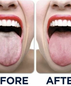 Beste Verkoop π JuliBrite Tong Gel (50 ML) Tongreinigende Gel - Verfrist De Adem - Schone Tong 𧨠11 Beste Verkoop π JuliBrite Tong Gel (50 ML) Tongreinigende Gel - Verfrist De Adem - Schone Tong 𧨠-L'OrΓ©al Shop 550x419 3