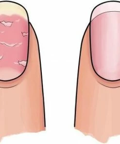 Hete verkoop ⭐ Herome 3 In 1 Manicure Nagelverzorging Set (Nail Essentials Roze) – Nagelset Voor Beschadigde Nagels – Nagelriemolie, Nagelriemcrème En Nagelverharder – Voor Mooie En Gezonde Nagels 🥰 19 Hete verkoop ⭐ Herome 3 In 1 Manicure Nagelverzorging Set (Nail Essentials Roze) – Nagelset Voor Beschadigde Nagels – Nagelriemolie, Nagelriemcrème En Nagelverharder – Voor Mooie En Gezonde Nagels 🥰 -L'Oréal Shop 550x423 2