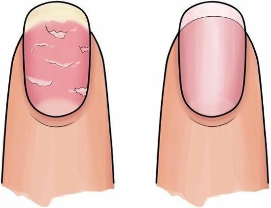 Hete verkoop ⭐ Herome 3 In 1 Manicure Nagelverzorging Set (Nail Essentials Roze) – Nagelset Voor Beschadigde Nagels – Nagelriemolie, Nagelriemcrème En Nagelverharder – Voor Mooie En Gezonde Nagels 🥰 6 Hete verkoop ⭐ Herome 3 In 1 Manicure Nagelverzorging Set (Nail Essentials Roze) – Nagelset Voor Beschadigde Nagels – Nagelriemolie, Nagelriemcrème En Nagelverharder – Voor Mooie En Gezonde Nagels 🥰 - Afbeelding 4