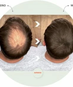 Beste deal π IMPERIO Premium Haarvezels Donkerbruin - Kaalheid Mannen - Alopecia Vrouwen - 100% Onzichtbaar π 32 Beste deal π IMPERIO Premium Haarvezels Donkerbruin - Kaalheid Mannen - Alopecia Vrouwen - 100% Onzichtbaar π -L'OrΓ©al Shop 550x463 2