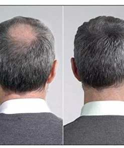 Beste deal π IMPERIO Premium Haarvezels Donkerbruin - Kaalheid Mannen - Alopecia Vrouwen - 100% Onzichtbaar π 35 Beste deal π IMPERIO Premium Haarvezels Donkerbruin - Kaalheid Mannen - Alopecia Vrouwen - 100% Onzichtbaar π -L'OrΓ©al Shop 550x465 3