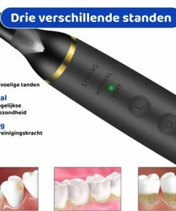 Nieuw π ExCorn Elektrische Tandsteen Verwijderaar - Elektrisch Tandplak Verwijderen - Inclusief Tandartssetje - Tanden Polijsten βοΈ 17 Nieuw π ExCorn Elektrische Tandsteen Verwijderaar - Elektrisch Tandplak Verwijderen - Inclusief Tandartssetje - Tanden Polijsten βοΈ -L'OrΓ©al Shop 550x483 1