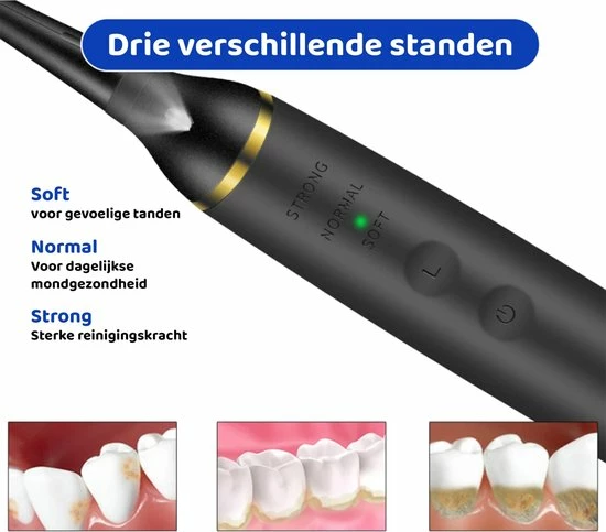 Nieuw π ExCorn Elektrische Tandsteen Verwijderaar - Elektrisch Tandplak Verwijderen - Inclusief Tandartssetje - Tanden Polijsten βοΈ 8 Nieuw π ExCorn Elektrische Tandsteen Verwijderaar - Elektrisch Tandplak Verwijderen - Inclusief Tandartssetje - Tanden Polijsten βοΈ - Afbeelding 6