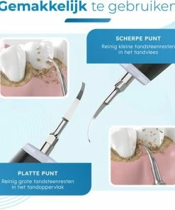 Goedkoopste π₯° V-Goods Premium Sonische Tandsteen Verwijderaar - 5 Standen - Inclusief Tandarts Set - 3 Opzetstukken - Tandplak π 14 Goedkoopste π₯° V-Goods Premium Sonische Tandsteen Verwijderaar - 5 Standen - Inclusief Tandarts Set - 3 Opzetstukken - Tandplak π -L'OrΓ©al Shop 550x500