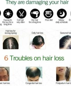 Coupon ⭐ 7Days Ginger Hair Nutrient Solution Haarserum 7days | Haarkuur 7daags | Haaruitval Bestrijden | Gember Extracten Voor Stimuleren Haargroei | Haar Olie | Bewezen Formule 😉 -L'Oréal Shop 550x504 5