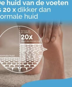 Flash-uitverkoop π Scholl Voetcrème - Intense Voedende Intens Crème - Zeer Droge Huid - 150 Ml π 11 Flash-uitverkoop π Scholl Voetcrème - Intense Voedende Intens Crème - Zeer Droge Huid - 150 Ml π -L'OrΓ©al Shop 550x529 3