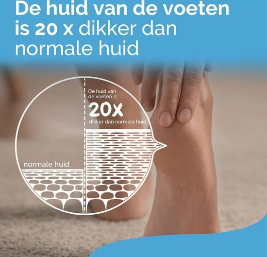 Flash-uitverkoop π Scholl Voetcrème - Intense Voedende Intens Crème - Zeer Droge Huid - 150 Ml π 6 Flash-uitverkoop π Scholl Voetcrème - Intense Voedende Intens Crème - Zeer Droge Huid - 150 Ml π - Afbeelding 4