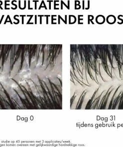 Aanbiedingen 😀 Vichy Dercos Anti-roos Shampoo Voor Normaal Tot Vet Haar - 2x390ml 🥰 -L'Oréal Shop 550x531 4