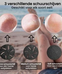 Beste deal ๐ Beeperfect® Elektrische Eeltverwijderaar Met Stofzuigsysteem - Voetvijl - Eeltvijl - IPX7 Waterdicht - Gratis Pedicure Set - ๐ 17 Beste deal ๐ Beeperfect® Elektrische Eeltverwijderaar Met Stofzuigsysteem - Voetvijl - Eeltvijl - IPX7 Waterdicht - Gratis Pedicure Set - ๐ -L'Orรฉal Shop 550x534 9