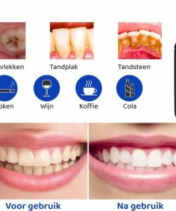 Nieuw π ExCorn Elektrische Tandsteen Verwijderaar - Elektrisch Tandplak Verwijderen - Inclusief Tandartssetje - Tanden Polijsten βοΈ 15 Nieuw π ExCorn Elektrische Tandsteen Verwijderaar - Elektrisch Tandplak Verwijderen - Inclusief Tandartssetje - Tanden Polijsten βοΈ -L'OrΓ©al Shop 550x537 6