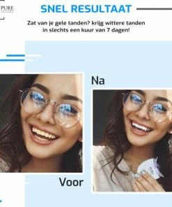 Coupon 🎁 Pure Luxure Teeth Whitening Kit - Zonder Peroxide - Met Handleiding En Ebook - Tandenbleekset - LED Tanden Bleken - Inclusief Whitening Strips - 100% Natuurlijk & Peroxidevrij - Black Friday 2022 💯 -L'Oréal Shop 550x538 2