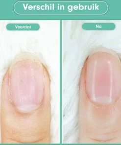 Gloednieuw π― Christian Deluxe - Baby Nagelknipper Groen - Baby Manicureset - Baby Verzorgingsset - Baby Nagelvijl - Baby Nagelschaartje - Baby Nagelset - Elektrisch π 12 Gloednieuw π― Christian Deluxe - Baby Nagelknipper Groen - Baby Manicureset - Baby Verzorgingsset - Baby Nagelvijl - Baby Nagelschaartje - Baby Nagelset - Elektrisch π -L'OrΓ©al Shop 550x546 6