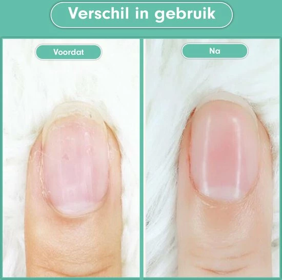 Gloednieuw π― Christian Deluxe - Baby Nagelknipper Groen - Baby Manicureset - Baby Verzorgingsset - Baby Nagelvijl - Baby Nagelschaartje - Baby Nagelset - Elektrisch π 6 Gloednieuw π― Christian Deluxe - Baby Nagelknipper Groen - Baby Manicureset - Baby Verzorgingsset - Baby Nagelvijl - Baby Nagelschaartje - Baby Nagelset - Elektrisch π - Afbeelding 4