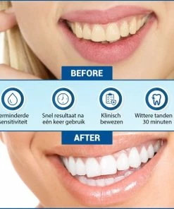 Nieuw 🤩 V-Goods Premium Whitening Strips - Tandenbleek Strips - Wittere Tanden - 28x Tandenbleek Strips DIRECT Resultaat - Tandenbleekset - Whitening - Tandenblekers ⭐ -L'Oréal Shop 550x549 100