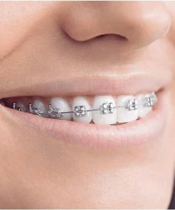 Beste Pirce βοΈ Oral B Oral-B Smartseries Teen - Elektrische Tandenborstel - Wit π 21 Beste Pirce βοΈ Oral B Oral-B Smartseries Teen - Elektrische Tandenborstel - Wit π -L'OrΓ©al Shop 550x550 1214