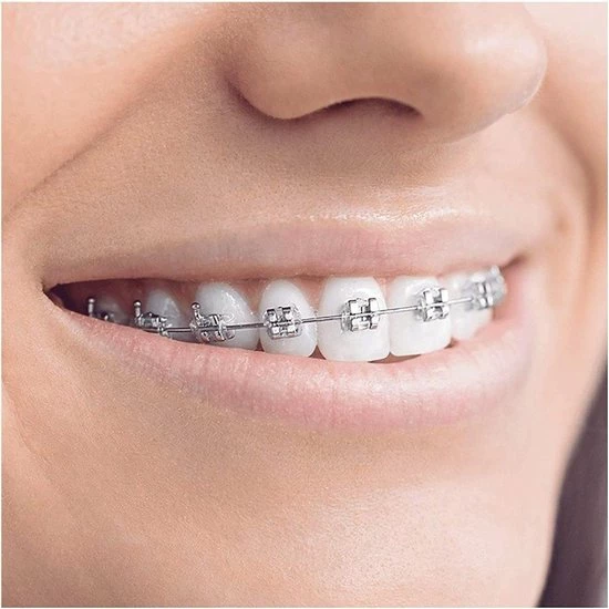 Beste Pirce βοΈ Oral B Oral-B Smartseries Teen - Elektrische Tandenborstel - Wit π 10 Beste Pirce βοΈ Oral B Oral-B Smartseries Teen - Elektrische Tandenborstel - Wit π - Afbeelding 8