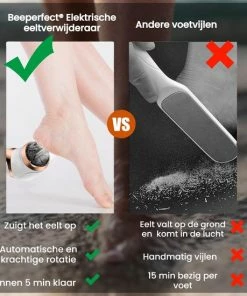 Beste deal ๐ Beeperfect® Elektrische Eeltverwijderaar Met Stofzuigsysteem - Voetvijl - Eeltvijl - IPX7 Waterdicht - Gratis Pedicure Set - ๐ 20 Beste deal ๐ Beeperfect® Elektrische Eeltverwijderaar Met Stofzuigsysteem - Voetvijl - Eeltvijl - IPX7 Waterdicht - Gratis Pedicure Set - ๐ -L'Orรฉal Shop 550x550 1224