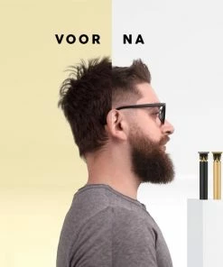 Beste deal π VRL Tondeuse – Trimmer Voor Mannen – Baard – Haartrimmer – Tondeuse Mannen Hoofdhaar – 0 Tot 9 Millimeter π 12 Beste deal π VRL Tondeuse – Trimmer Voor Mannen – Baard – Haartrimmer – Tondeuse Mannen Hoofdhaar – 0 Tot 9 Millimeter π -L'OrΓ©al Shop 550x550 1488