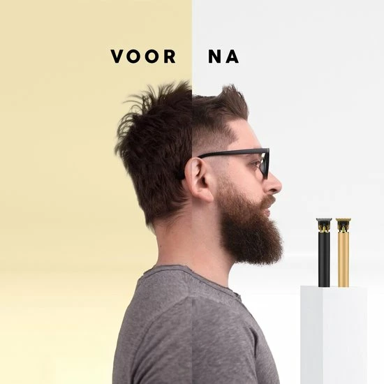 Beste deal π VRL Tondeuse – Trimmer Voor Mannen – Baard – Haartrimmer – Tondeuse Mannen Hoofdhaar – 0 Tot 9 Millimeter π 5 Beste deal π VRL Tondeuse – Trimmer Voor Mannen – Baard – Haartrimmer – Tondeuse Mannen Hoofdhaar – 0 Tot 9 Millimeter π - Afbeelding 3