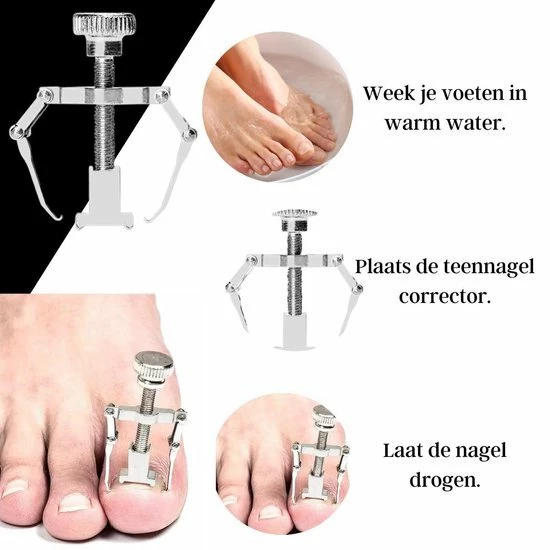 Gloednieuw 🤩 LOUZIR 7-Delige Pedicure Set - Nagelverzorging - Nagelset - Ingegroeide Teennagel - Nagelknipper - Nail Clippers - Ingrown Toenail 💯 14 Gloednieuw 🤩 LOUZIR 7-Delige Pedicure Set - Nagelverzorging - Nagelset - Ingegroeide Teennagel - Nagelknipper - Nail Clippers - Ingrown Toenail 💯 - Afbeelding 12