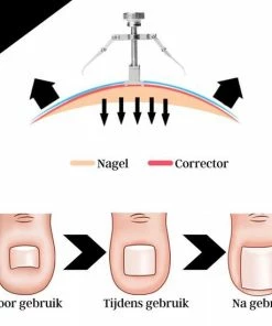Gloednieuw 🤩 LOUZIR 7-Delige Pedicure Set - Nagelverzorging - Nagelset - Ingegroeide Teennagel - Nagelknipper - Nail Clippers - Ingrown Toenail 💯 29 Gloednieuw 🤩 LOUZIR 7-Delige Pedicure Set - Nagelverzorging - Nagelset - Ingegroeide Teennagel - Nagelknipper - Nail Clippers - Ingrown Toenail 💯 -L'Oréal Shop 550x550 1521