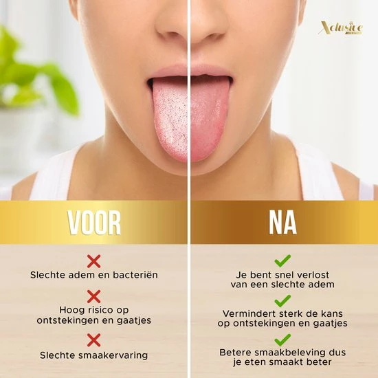 Nieuw 💯 Xclusive-lifestyle® Luxe Rosé Tongschraperset - RVS Tongreiniger - 4-Delig - Ayurveda - Tongschraper - Mondverzorging - Mondhygiëne - Luxe Case - Herbruikbaar & Duurzaam - Sinterklaas Cadeau 🔔 6 Nieuw 💯 Xclusive-lifestyle® Luxe Rosé Tongschraperset - RVS Tongreiniger - 4-Delig - Ayurveda - Tongschraper - Mondverzorging - Mondhygiëne - Luxe Case - Herbruikbaar & Duurzaam - Sinterklaas Cadeau 🔔 - Afbeelding 4