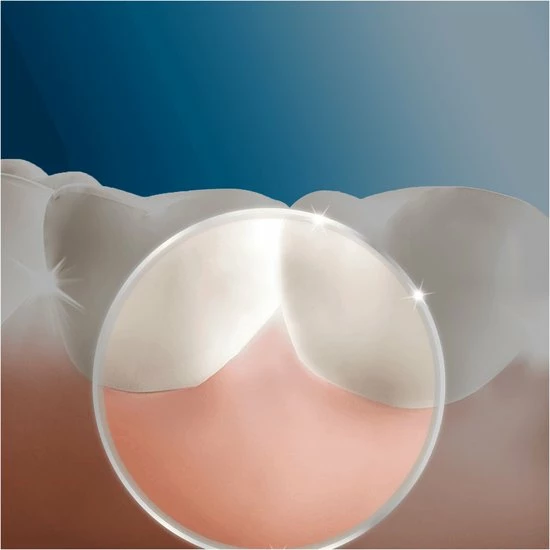 Beste Pirce π Oral B Oral-B OxyJet - Blauw, Wit - Waterflosser π 4 Beste Pirce π Oral B Oral-B OxyJet - Blauw, Wit - Waterflosser π - Afbeelding 2