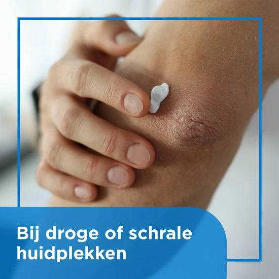 Kopen π Bepanthen Beschermende Zalf - Intensief Vettende Zalf - Zonder Parfum - Droge Of Schrale Huidplekken - 50 Gram β 9 Kopen π Bepanthen Beschermende Zalf - Intensief Vettende Zalf - Zonder Parfum - Droge Of Schrale Huidplekken - 50 Gram β - Afbeelding 7