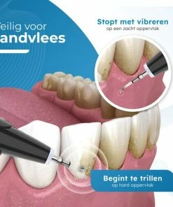 Goedkoopste π₯° V-Goods Premium Sonische Tandsteen Verwijderaar - 5 Standen - Inclusief Tandarts Set - 3 Opzetstukken - Tandplak π 13 Goedkoopste π₯° V-Goods Premium Sonische Tandsteen Verwijderaar - 5 Standen - Inclusief Tandarts Set - 3 Opzetstukken - Tandplak π -L'OrΓ©al Shop 550x550 334