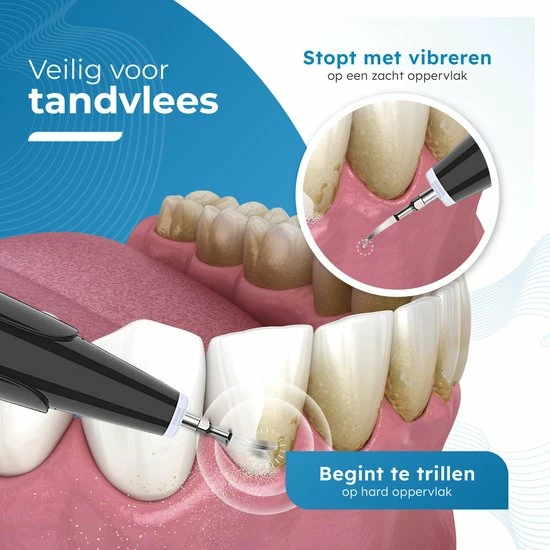 Goedkoopste π₯° V-Goods Premium Sonische Tandsteen Verwijderaar - 5 Standen - Inclusief Tandarts Set - 3 Opzetstukken - Tandplak π 6 Goedkoopste π₯° V-Goods Premium Sonische Tandsteen Verwijderaar - 5 Standen - Inclusief Tandarts Set - 3 Opzetstukken - Tandplak π - Afbeelding 4