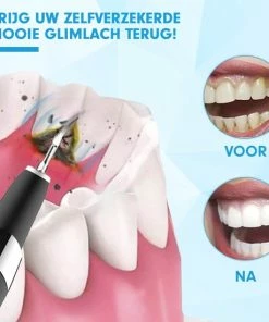 Goedkoop 💯 DEN-T® PRO U500 - Elektrische Sonische Tandsteen Verwijderaar - Zwart 🥰 16 Goedkoop 💯 DEN-T® PRO U500 - Elektrische Sonische Tandsteen Verwijderaar - Zwart 🥰 -L'Oréal Shop 550x550 406