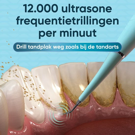 Beste Verkoop π ProTrue Whitee Elektrische Tandsteen Verwijderaar - Tanden Polijsten - Tandarts Tandsteenverwijderaars - Elektrisch Tandplak Verwijderen β 8 Beste Verkoop π ProTrue Whitee Elektrische Tandsteen Verwijderaar - Tanden Polijsten - Tandarts Tandsteenverwijderaars - Elektrisch Tandplak Verwijderen β - Afbeelding 6