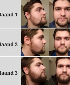 Korting π LB Products™ Baardgroei Olie - Baardolie - Baard Groei Middel - Baardhaar - Baardgroei Stimuleren - Versnellen 30 Ml π 16 Korting π LB Products™ Baardgroei Olie - Baardolie - Baard Groei Middel - Baardhaar - Baardgroei Stimuleren - Versnellen 30 Ml π -L'OrΓ©al Shop 550x550 718