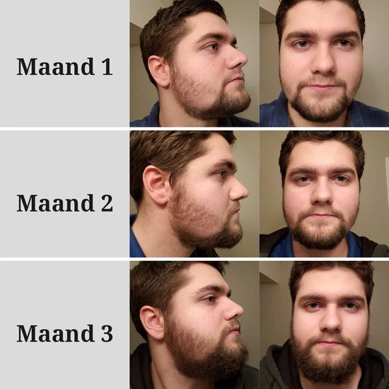 Korting π LB Products™ Baardgroei Olie - Baardolie - Baard Groei Middel - Baardhaar - Baardgroei Stimuleren - Versnellen 30 Ml π 7 Korting π LB Products™ Baardgroei Olie - Baardolie - Baard Groei Middel - Baardhaar - Baardgroei Stimuleren - Versnellen 30 Ml π - Afbeelding 5