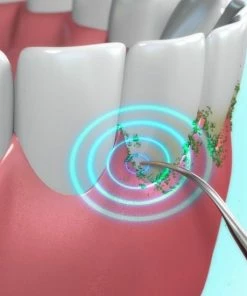 Beste recensies van ✨ Toppers Van TV - Sonic Tandsteenverwijderaar - Tandplakverwijderaar ⭐ 17 Beste recensies van ✨ Toppers Van TV - Sonic Tandsteenverwijderaar - Tandplakverwijderaar ⭐ -L'Oréal Shop 550x550 859