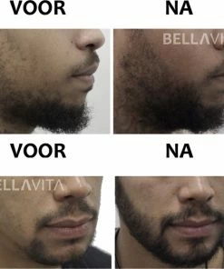 Beste Pirce ✔️ BELLAVITA Baardgroei Kit - 9 Delig - Baardgroei Set - Baardolie - Baard Set - Baard - Giftset - Black Friday - Sinterklaas - Kerst - Baardverzorging - Baardbalsem - Baardgroei - Cadeau - 100% Natuurlijk ✔️ 16 Beste Pirce ✔️ BELLAVITA Baardgroei Kit - 9 Delig - Baardgroei Set - Baardolie - Baard Set - Baard - Giftset - Black Friday - Sinterklaas - Kerst - Baardverzorging - Baardbalsem - Baardgroei - Cadeau - 100% Natuurlijk ✔️ -L'Oréal Shop 550x551 23