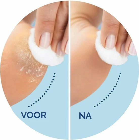 Top 10 π― Scholl Velvet Smooth - Navulling Eeltverwijderaar - Regular - Voetvijl - 2 Stuks π 5 Top 10 π― Scholl Velvet Smooth - Navulling Eeltverwijderaar - Regular - Voetvijl - 2 Stuks π - Afbeelding 3