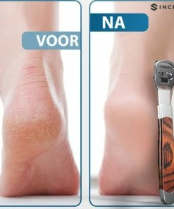 Beste recensies van 💯 Sincer Eelt Verwijderaar Met Luxe Opbergkoker– Inclusief 10 Dubbelzijdige Mesjes - Pedicure Apparaat – Voetverzorging – Voetvijl – Eeltrasp – Eeltschaaf – Eeltschraper – Puimsteen - Roestvrij Staal ✨ -L'Oréal Shop 550x553 5