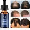 Coupon π Delta Care Regrowth | Haarserum - Alternatief Minoxidil 5% - Haargroei Producten π 2 Coupon π Delta Care Regrowth | Haarserum - Alternatief Minoxidil 5% - Haargroei Producten π -L'OrΓ©al Shop 550x556 16