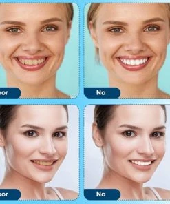 Korting ⭐ Imperatoris Diamond White - Teeth Whitening Strips - 28x Strips - Zonder Peroxide (0%) - Tandenbleekset – Mint ✔️ -L'Oréal Shop 550x556 19