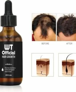 Promo 😍 Merkloos Haarserum - Haargroei Stimulator - Tegen Haaruitval - Baardgroeimiddel ✨