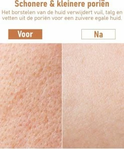 Goedkoop π€© Fesio Lichaamsborstel Met Lange Steel - Dubbelzijdig - Dry Brushing Rugborstel/Badborstel/Doucheborstel/Huidborstel - 43 Cm π 16 Goedkoop π€© Fesio Lichaamsborstel Met Lange Steel - Dubbelzijdig - Dry Brushing Rugborstel/Badborstel/Doucheborstel/Huidborstel - 43 Cm π -L'OrΓ©al Shop 550x610